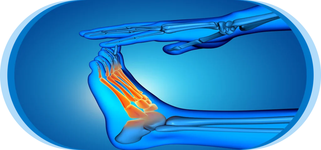 Tibial Condylar Valgus Osteotomy (TCVO) in Nagpur